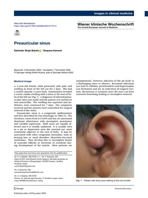 Preauricular Sinus Pdf Ear Epidemiology