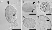 Trophozoites of Balantidium coli in formalin preserved feces of a ...