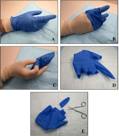 Photographs Demonstrating Digital Rectal Exam Dre Glove Removal