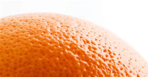 Do You Have Orange Peel Skin How To Treat It — And How To Avoid It