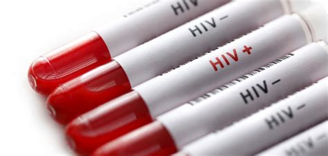 Hiv Potential Cure For Hiv An Enzyme That Cuts The Virus Hiv