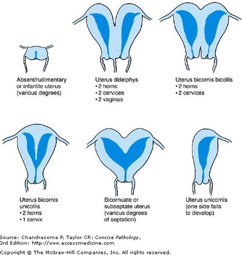 Chapter The Uterus Vagina Vulva Concise Pathology E