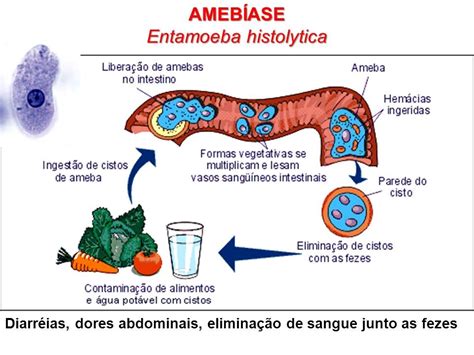 Amebíase O Que é Sintomas Causas Diagnóstico E Tratamento