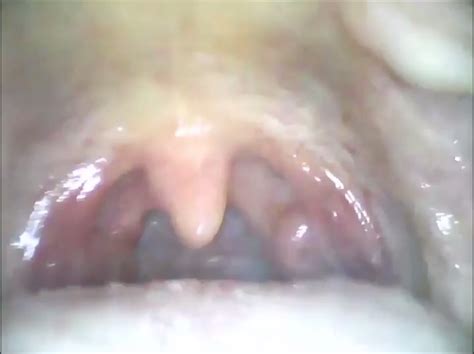 Alandra Yawning Uvula Clip Thisvid Com