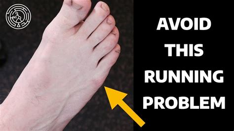 Outside Foot Pain