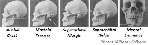 Quick Tips How To Estimate The Biological Sex Of A Human Skeleton Skull Method All Things