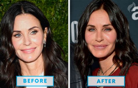 Before And After Photos Of The Celebrities With The Most Obscene