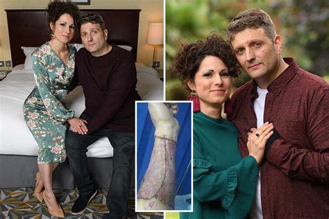 Man Born Without Penis Given £50 000 Bionic Willy By Surgeons Finally Has Sex With His