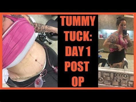 TUMMY TUCK DAY 1 POST OP YouTube