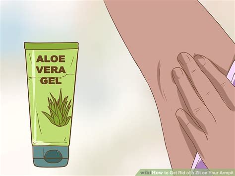 4 Ways To Get Rid Of A Zit On Your Armpit Wikihow