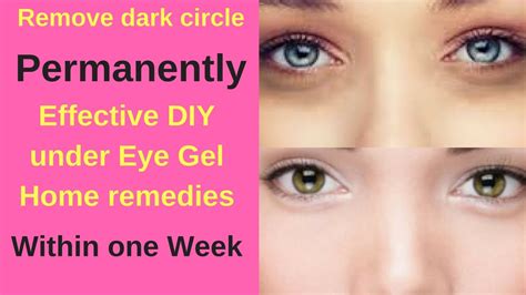 How To Remove Dark Circle Under Eyes Permanently Within 1 Week Diy