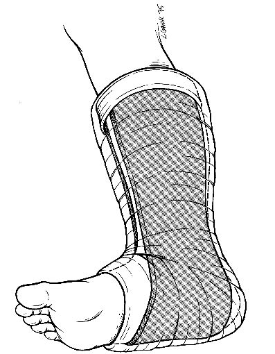 Ankle Stirrup Splint Wikem