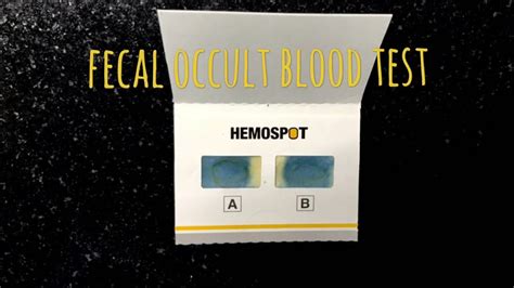 Fecal Occult Blood Test Made Simple Youtube