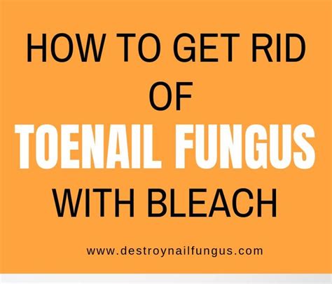 Posted on august 20, 2017. Bleach For Ringworms : How To Get Rid of Ringworms? 25 Effective Home Remedies To Look Into ...