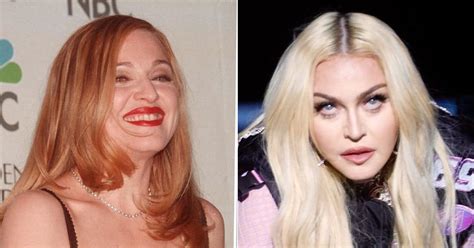 What Plastic Surgery Has Madonna Gotten See Singer S Transformation