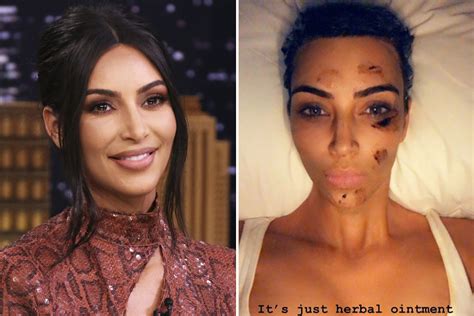 Kim Kardashian Says She Avoids Smiling So She Doesnt Get Wrinkles The Irish Sun