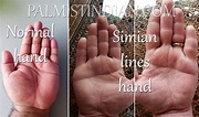 Simian Line In Palmistry - Comparison analysis - Palmist Manish