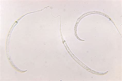 Images Human Parasites Under The Microscope Live Science