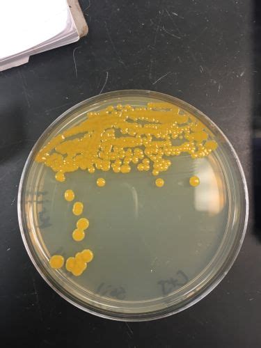 Bacillus Cereus Nutrient Agar