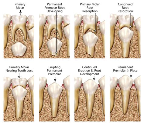 permanent teeth eruption timetable sorident