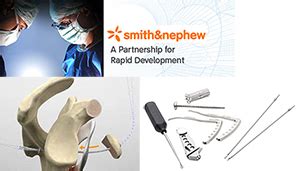Process associate, human resource coordinator, product specialist and more on indeed.com. How Smith & Nephew's InVentures program is promoting ...