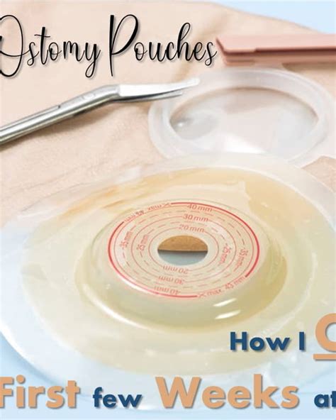 Managing A Colostomy After Colon Surgery My Experience Patients Lounge