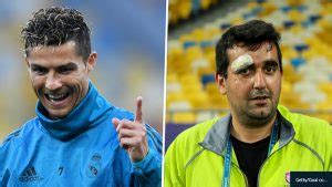 There are a bunch of things zidane does that affect. Cristiano Ronaldo Splits Cameraman's Head Open In Champions League Final Warm-Up - Classic Ghana