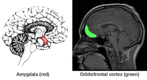Amygdala And Orbitofrontal Cortex The Brain Bank North West