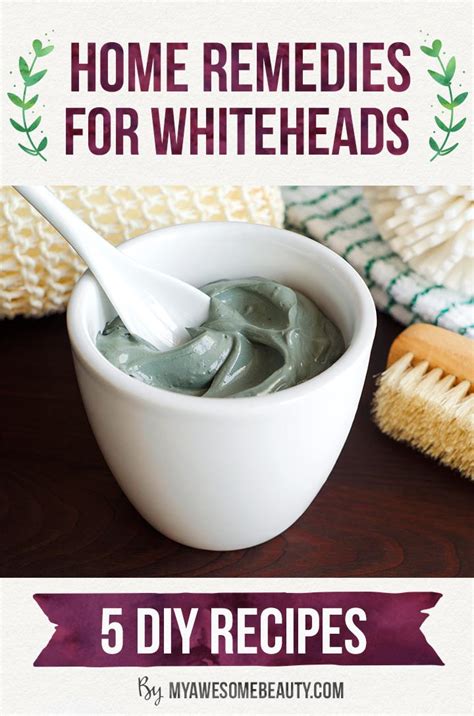 How To Get Rid Of Whiteheads Fast And Safely On Face 7 Day Treatment