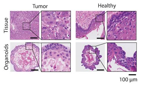 Healthy Versus Tumor Tissue An Image Eurekalert Science News Releases