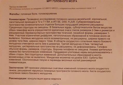 Киста в печени диета лечение Киста в головном мозге - Вопрос нейрохирургу - 03 Онлайн Киста в головном мозге - Вопрос нейрохирургу - 03 Онлайн Киста в печени диета лечение