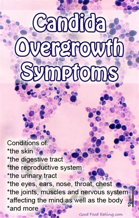 Candida Overgrowth Symptoms Candida Overgrowth Symptoms Candida