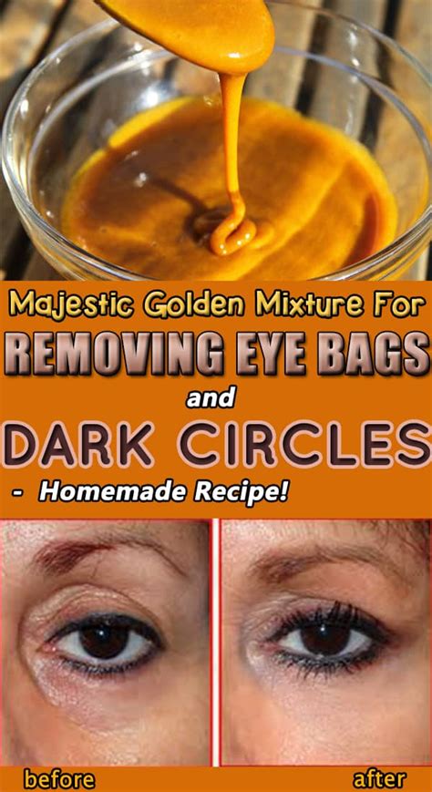 Natural Remedies That Will Help You Remove The Dark Circles Under Your