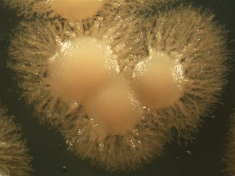 Colonias De Aureobasidium Pullulans