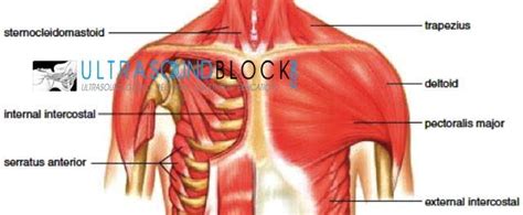 The chest wall is comprised of skin, fat, muscles, and the thoracic skeleton. Ultrasound: Thoracic wall (PECS) blocks