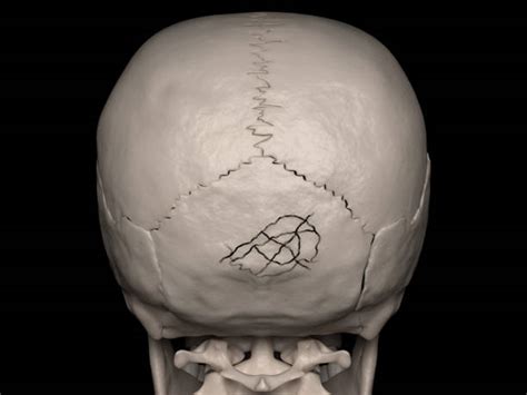 Occipital Bone Stock Photos Pictures And Royalty Free Images Istock