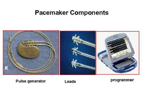 Pacemakers And Implantable Defibrillators Worldwide