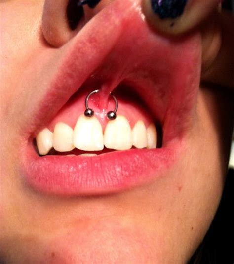 I Dont Understand Why Someone Would Do This Piercing Smiley