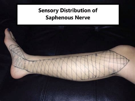 Saphenous Nerve Distribution Download Scientific Diagram