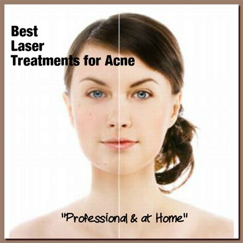 Best Laser Treatment For Acne Top 3 At Home Acne Devices Hubpages