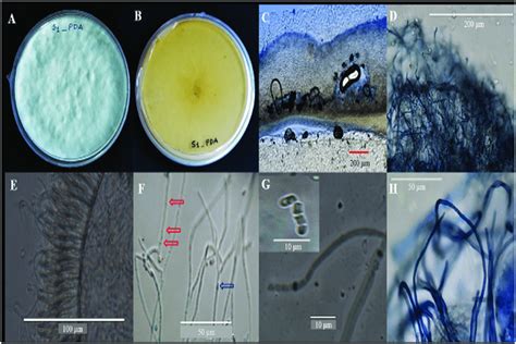 Macroscopic And Microscopic Characterization Of The Fungal Isolate 20