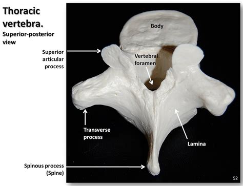 Thoracic Vertebra Posterior Superior View With Labels A Flickr