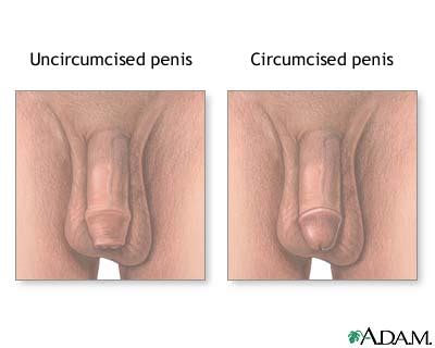 How To Clean An Uncircumcised Penis XXX Porn Library