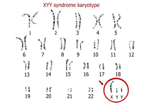 Y Chromosome The Definitive Guide Biology Dictionary