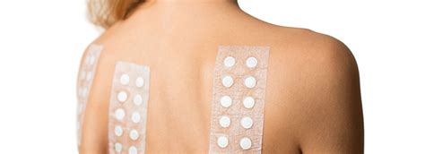 Dermal Patch Allergy Testing In Columbia Columbia Skin Clinic