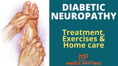 Diabetic Neuropathy Treatment Exercises Home Care For Diabetic Neuropathy Hindi Mera