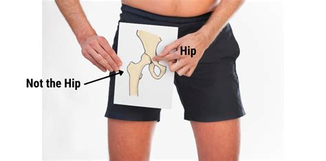 Groin Pain Is It Your Hip Parkside Sports Physiotherapy