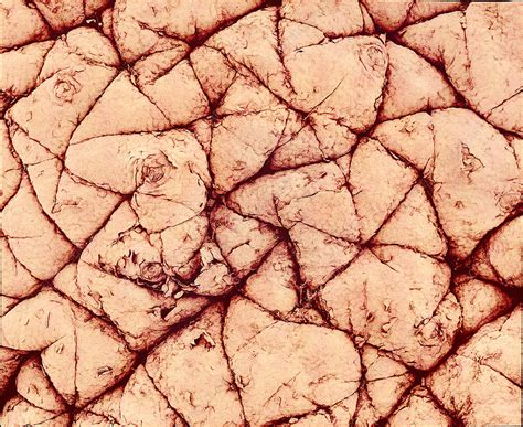 Human Skin Surface Sem Stock Image P7100357 Science Photo Library