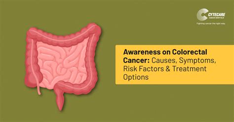 Colon Cancer Causes Symptoms Risk Factors Treatment