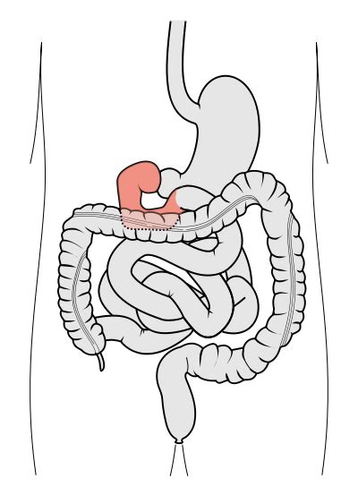 Duodenum Anatomy Location Parts And Pictures